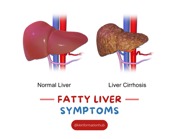 Life Expectancy With Fatty Liver Disease