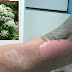 Το  γιγαντιαίο ηράκλειο  - ένα είδους φυτού που καίει το δέρμα και προκαλεί τύφλωση! VIDEO