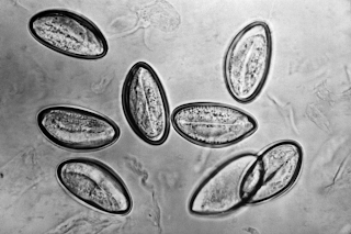 jaja owsików pod mikroskopem
