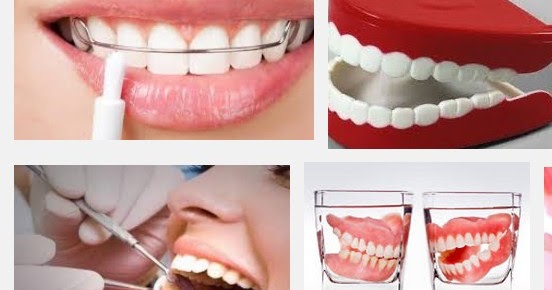 Berapakah Biaya Pasang Gigi Palsu Permanen di Dokter Gigi 