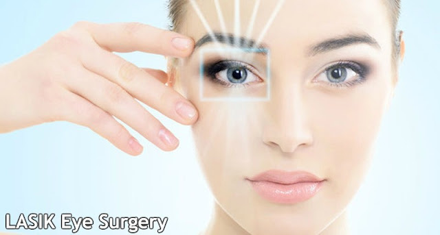 LASIK Eye Surgery