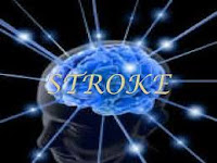 mengenal penyakit stroke