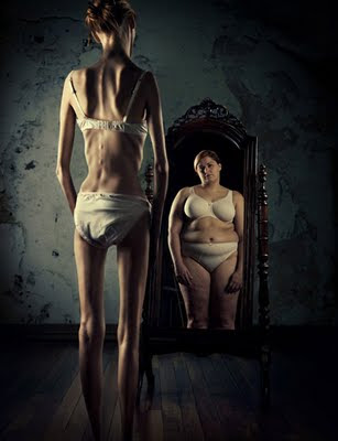 <b>Anorexia</b> <b>nervosa</b> is a complex eating disorder with three key features: