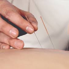 Man using Acupuncture needles