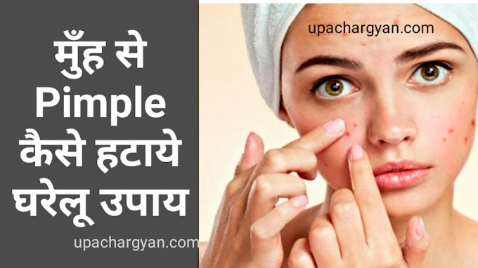 पिम्पल्स कैसे दूर करे -Pimple Hatane Ke Upay In Hindi