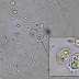 Giardia Cysts In Stool Images