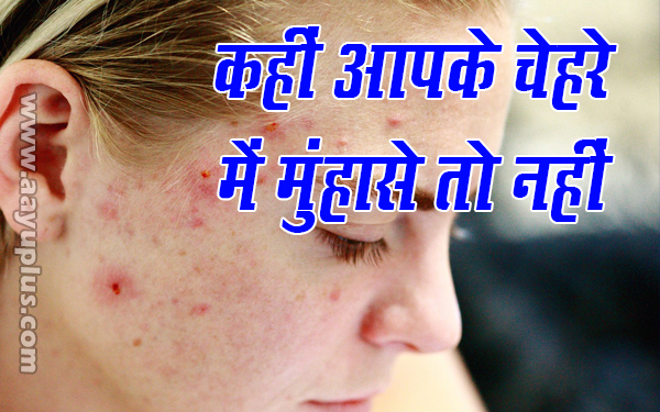 कही आपके चेहरे में मुहासे तो नहीं Have pimples on your face?