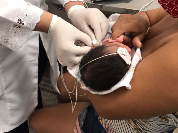Teste da orelhinha realizado por fonoaudiólogos alcança 99,6 % dos recém-nascidos do Hospital de Base Dr. Ary Pinheiro