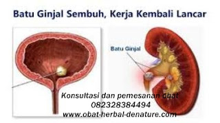 cara menghancurkan batu ginjal tanpa operasi,obat batu ginjal,obat kencing batu,cara mengeluarkan batu ginjal tanpa operasi,cara menghilangkan batu ginjal tanpa operasi