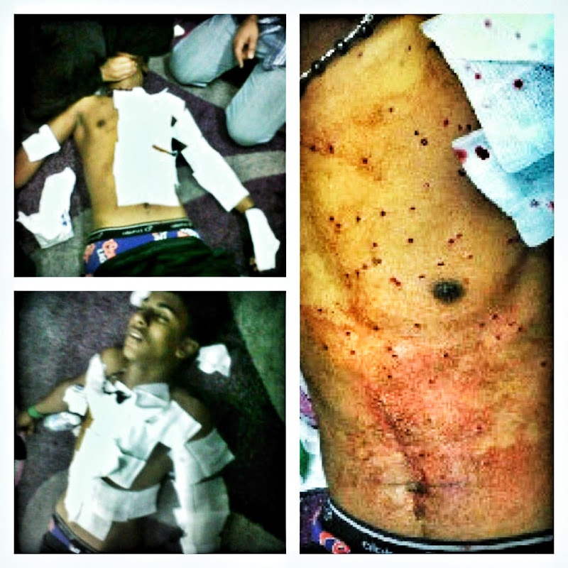 Bahrain authority escalates its level of excessive force against pro  title=