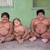 Father Plans To Sell Own Kidney To Save His 3 Deadly Obese Kids