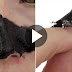 Make Your Own Charcoal Nose Peels To Get Rid Of Blackheads