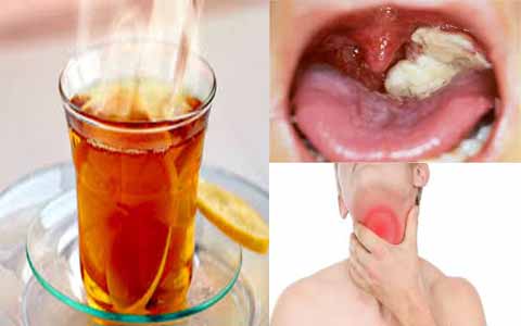 Bahaya Minum Teh Panas Bahaya Minum Teh Panas