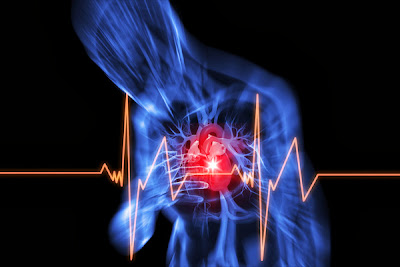 PTCA, technology can extend the age of Heart Pain Sufferers