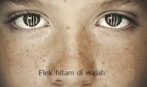 Cara mudah menghilangkan flek hitam di wajah secara alami