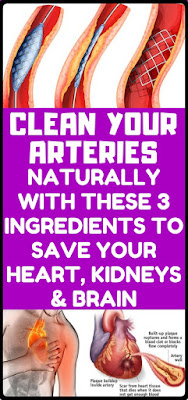 How to clean out plaque in arteries – 3 ingredients mixture