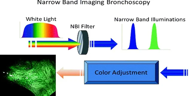 தகவல் தொடர்புக்கான Narrow Band என்றால் என்ன?