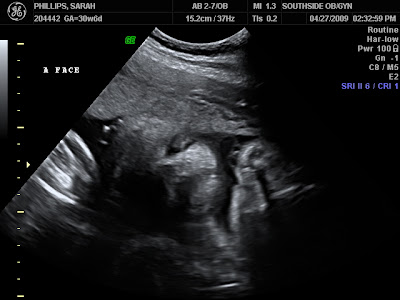 Philips Ultrasonic on The Phillips Family  Ultrasound Appointment