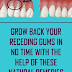 Treat Receding Gums Naturally Using These Methods