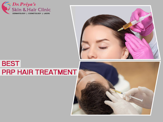Best PRP Hair Treatment In Marathahalli Bangalore