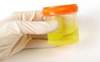 7 Amazing Benefits Of Urine Therapy For Different Health Complications