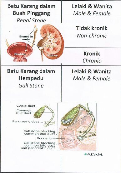 Kenali Batu Karang dalam Hempedu ~ Mommy Razim and Sarhan