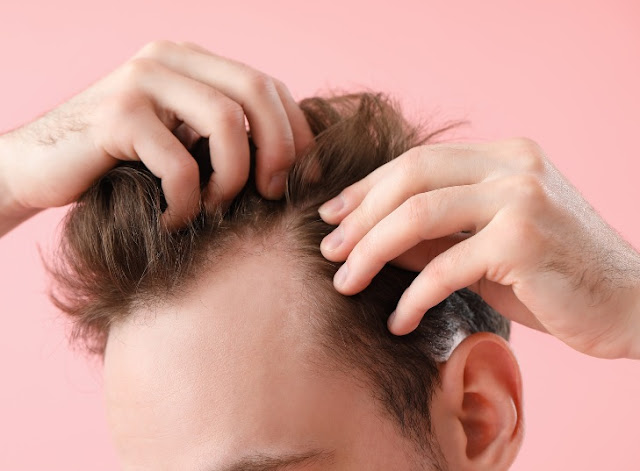 signs that you'll lose your hair by the age of 40