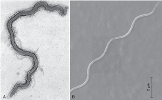 Hình 1: Ảnh Borrelia burgdoferi dưới kính hiển vi