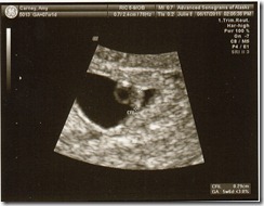 ultrasound2