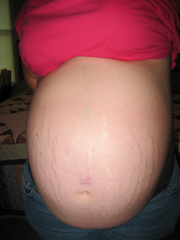 How to Prevent Pregnancy Stretch Marks
<div class='clear:both;'></div>
<div id='post-wrapper-ads1'>
</div>
</div>
<div style='clear: both;'></div>
<div class='jos-author' style='background-color:#f7f7f7; color:#222; margin-bottom:7px; margin-top:2px; padding:5px 5px 5px'>
<span itemprop='itemreviewed'>Tiny Nose Piercings ~
      </span>Rating: <span class='rating' itemprop='rating'><strong>4.7</strong></span>
</div>
</div>
<br/>
<div style='clear: both;'></div>
<div id='related_posts'>
<h3>Artikel Terkait Tiny Nose Piercings</h3>
<script src='/feeds/posts/default/-/nose?alt=json-in-script&callback=relpostimgcuplik&max-results=50' type='text/javascript'></script>
<script src='/feeds/posts/default/-/piercings?alt=json-in-script&callback=relpostimgcuplik&max-results=50' type='text/javascript'></script>
<script src='/feeds/posts/default/-/tiny?alt=json-in-script&callback=relpostimgcuplik&max-results=50' type='text/javascript'></script>
<ul id='relpost_img_sum'>
<script type='text/javascript'>artikelterkait();</script>
</ul>
</div>
</div>
<div class='comments' id='comments'>
<a name='comments'></a>
<div id='backlinks-container'>
<div id='Blog1_backlinks-container'>
</div>
</div>
</div>
</div>

        </div></div>
      
<!--Can't find substitution for tag [adEnd]-->
</div>
<div class='blog-pager' id='blog-pager'>
<span id='blog-pager-newer-link'>
<a class='blog-pager-newer-link' href='http://dramatic-makeup.blogspot.com/2015/08/tiffany-snsd-piercings.html' id='Blog1_blog-pager-newer-link' title='Newer Post'>← Newer Post</a>
</span>
<span id='blog-pager-older-link'>
<a class='blog-pager-older-link' href='http://dramatic-makeup.blogspot.com/2015/08/tips-on-nose-piercings.html' id='Blog1_blog-pager-older-link' title='Older Post'>Older Post →</a>
</span>
<a class='home-link' href='http://dramatic-makeup.blogspot.com/'>Home</a>
</div>
<div class='clear'></div>
<div class='post-feeds'>
</div>
</div></div>
</aside>
<!-- post wrapper end -->
<!-- sidebar wrapper start -->
<aside id='sidebar-wrapper'>
<div class='sidebar section' id='sidebar'><div class='widget PopularPosts' data-version='1' id='PopularPosts1'>
<h2>Popular Posts</h2>
<div class='widget-content popular-posts'>
<ul>
<li>
<div class='item-content'>
<div class='item-thumbnail'>
<a href='http://dramatic-makeup.blogspot.com/2014/08/skyrim-unpb-bbp-piercings.html' target='_blank'>
<img alt='' border='0' src='https://blogger.googleusercontent.com/img/b/R29vZ2xl/AVvXsEjfKqhJD6j8wy0t7wv48pPwqPel11HZyHXfs7MvAIqsmKh2Z1KL2eosqIAaqsoLS6hqsMUZekufU_uK0MQ5wiPviGkiW-lj5sJAfle94wRCWTKgJCEbFdUI0S1TAynbee0cFpist5SfMg0h/w72-h72-p-k-no-nu/2013-12-18_00020.jpg'/>
</a>
</div>
<div class='item-title'><a href='http://dramatic-makeup.blogspot.com/2014/08/skyrim-unpb-bbp-piercings.html'>Skyrim Unpb Bbp Piercings</a></div>
<div class='item-snippet'>skyrim unpb bbp piercings  – Find the newest extraordinary kitchen design ideas especially some topics related to skyrim unpb bbp piercings ...</div>
</div>
<div style='clear: both;'></div>
</li>
<li>
<div class='item-content'>
<div class='item-thumbnail'>
<a href='http://dramatic-makeup.blogspot.com/2014/10/elaine-davidson-genital-piercings_29.html' target='_blank'>
<img alt='' border='0' src='https://blogger.googleusercontent.com/img/b/R29vZ2xl/AVvXsEhnKrAdQ789-Jp2NMvCi_MCH54jjyPfLXhy7yo5o47kgf25XSUXZqbyWCez2lF06ERKUnxqjU97VQ9CGXjsvXEo8uGVLAU45BIlJhlUK2p0Szr2RZE9ZL4j_J-NARbstXfozq-GUrKpPDs/w72-h72-p-k-no-nu/DD7.jpg'/>
</a>
</div>
<div class='item-title'><a href='http://dramatic-makeup.blogspot.com/2014/10/elaine-davidson-genital-piercings_29.html'>Elaine Davidson Genital Piercings Pictures</a></div>
<div class='item-snippet'>elaine davidson genital piercings pictures  – Find the newest extraordinary kitchen design ideas especially some topics related to elaine da...</div>
</div>
<div style='clear: both;'></div>
</li>
<li>
<div class='item-content'>
<div class='item-thumbnail'>
<a href='http://dramatic-makeup.blogspot.com/2014/10/emma-watson-piercings.html' target='_blank'>
<img alt='' border='0' src='https://blogger.googleusercontent.com/img/b/R29vZ2xl/AVvXsEgKVfLLB6CxAs4q7ksztuDPxzKSJKQvaQrW1HSEwy0QmyoXRU_oCyW90xOaWtr28O3zJpyPnJ6ZNwsUJ7N_N6dIV-c3hoOKY-CLYA1uZvEuwKCEe4KBvEmnUxjGeAbZ-ZthNY8owlI8qMiA/w72-h72-p-k-no-nu/emma-watson-harry-potter-premiere.jpg'/>
</a>
</div>
<div class='item-title'><a href='http://dramatic-makeup.blogspot.com/2014/10/emma-watson-piercings.html'>Emma Watson Piercings</a></div>
<div class='item-snippet'>emma watson piercings  – Find the newest extraordinary kitchen design ideas especially some topics related to emma watson piercings only in ...</div>
</div>
<div style='clear: both;'></div>
</li>
<li>
<div class='item-content'>
<div class='item-thumbnail'>
<a href='http://dramatic-makeup.blogspot.com/2014/08/body-piercings-pictures-female.html' target='_blank'>
<img alt='' border='0' src='http://4.bp.blogspot.com/-SImb0en53mE/Tnz09V4RX4I/AAAAAAAAAAk/XHV5K7fwdWE/w72-h72-p-k-no-nu/belly+button+piercing1.jpg'/>
</a>
</div>
<div class='item-title'><a href='http://dramatic-makeup.blogspot.com/2014/08/body-piercings-pictures-female.html'>Body Piercings Pictures Female</a></div>
<div class='item-snippet'>body piercings pictures female  photos and pictures collection that posted here was carefully selected and uploaded by Rockymage team after ...</div>
</div>
<div style='clear: both;'></div>
</li>
<li>
<div class='item-content'>
<div class='item-thumbnail'>
<a href='http://dramatic-makeup.blogspot.com/2014/09/cheek-piercings.html' target='_blank'>
<img alt='' border='0' src='https://blogger.googleusercontent.com/img/b/R29vZ2xl/AVvXsEj2e6Y-XrX85YuIMFUNi9tiqeS0feePq0th1KqeEUUzPfEG_O6CwAYcqDiCok9XmRnvY7dPBrj_gLGlPlsPj9fSzGd_uCXzV_YI4blc0uKnv2DF5VcWUVHoJgl-Fa6R6KK15L0gQTsSg1o/w72-h72-p-k-no-nu/P1040102.JPG'/>
</a>
</div>
<div class='item-title'><a href='http://dramatic-makeup.blogspot.com/2014/09/cheek-piercings.html'>Cheek Piercings</a></div>
<div class='item-snippet'>cheek piercings  photos and pictures collection that posted here was carefully selected and uploaded by Rockymage team after choosing the on...</div>
</div>
<div style='clear: both;'></div>
</li>
</ul>
<div class='clear'></div>
</div>
</div><div class='widget HTML' data-version='1' id='HTML2'>
<div class='widget-content'>
<!-- Histats.com  START (hidden counter)-->
<script type=