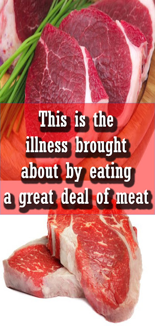 This Is The Illness Brought About By Eating A Great Deal Of Meat