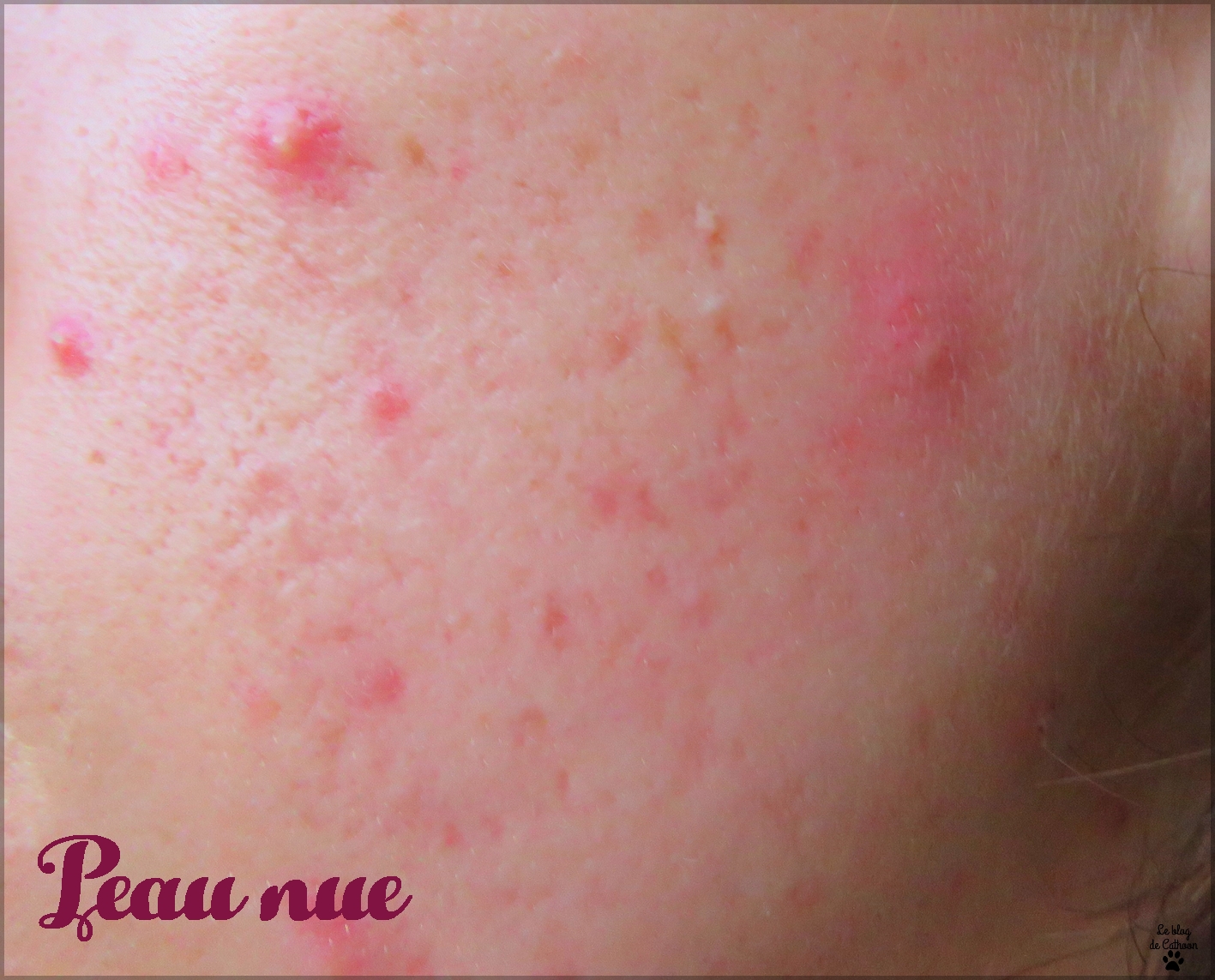 Skin Essentials - Spot Patch - Alvira - Action