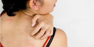 overcome your itchy skin | effective way to overcome itchy skin