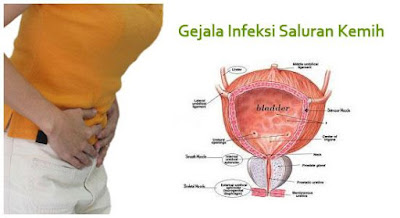 Infeksi Saluran Kencing, ISK, Infeksi Saluran Kemih