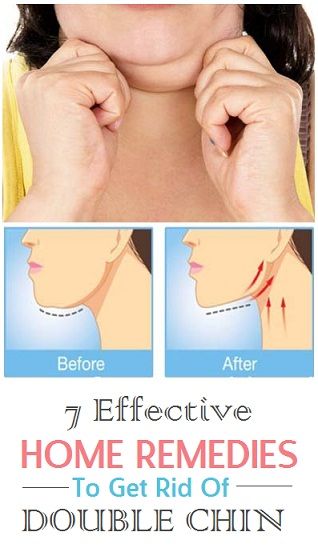 7 Effective Home Remedies To Get Rid Of Double Chin Fast