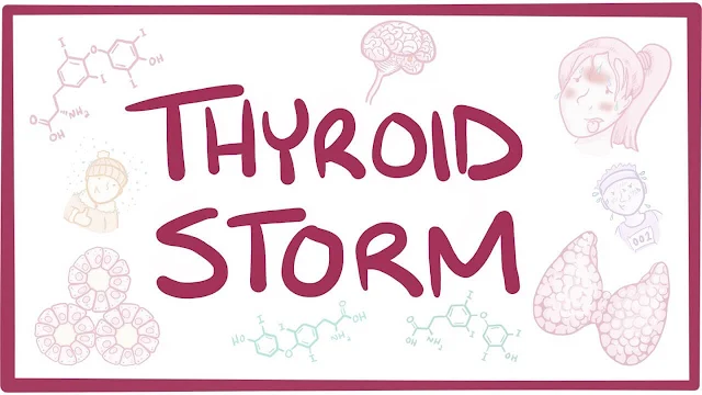 Thyroid-storm