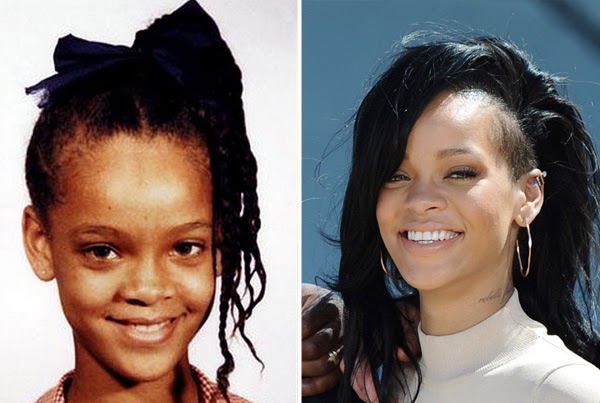 Resultado de imagem para famosos antes e depois