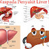 Bagaimana Cara mengobati penyakit liver yang sudah menahun thumbnail