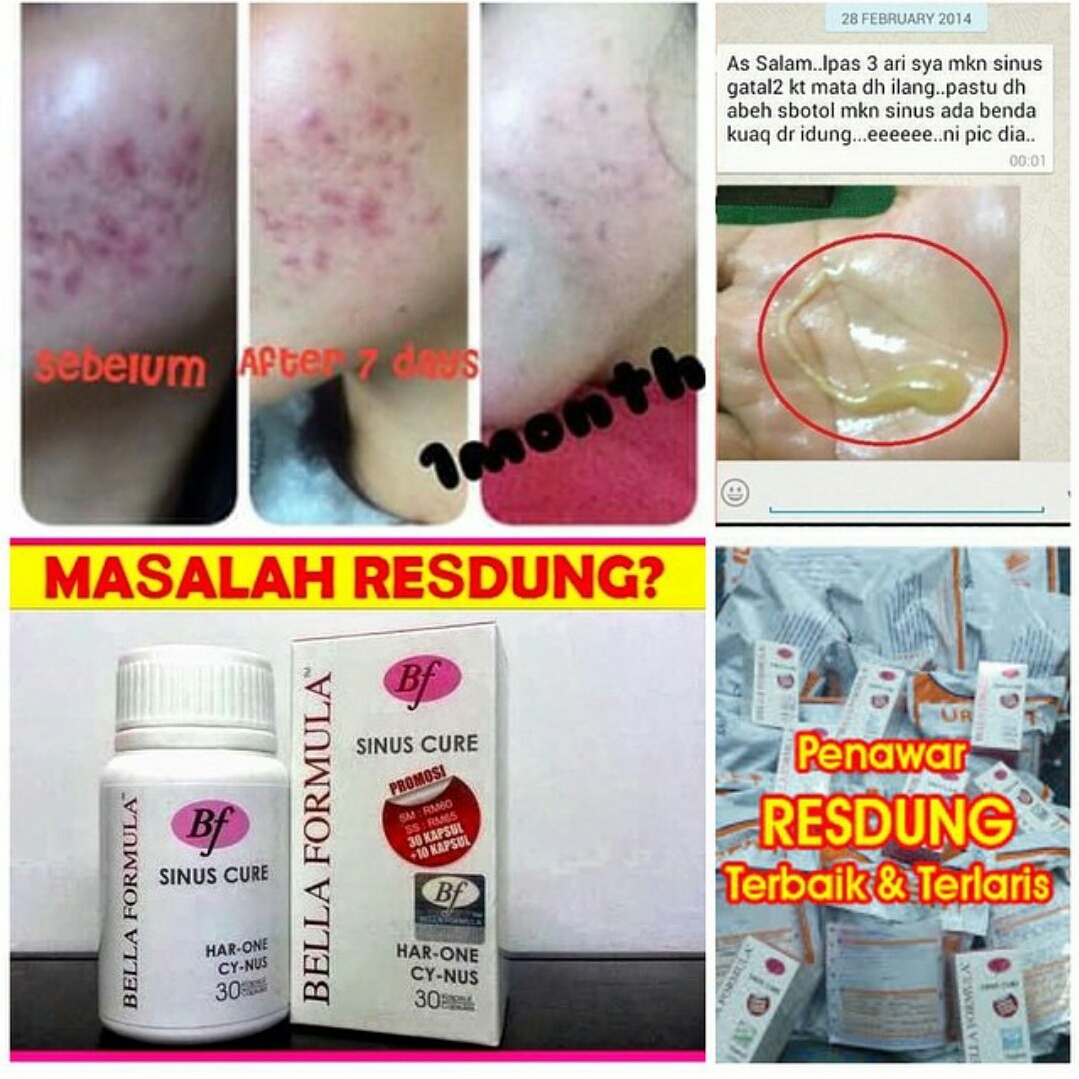 Ubat Resdung Sinus Care - Situs Contoh d