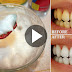 How To Whiten Your Yellow Teeth In 1 Minute At Home