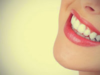 INFO KESEHATAN - Cara Alami Hilangkan Plak dan Kuning Pada Gigi Terbaru