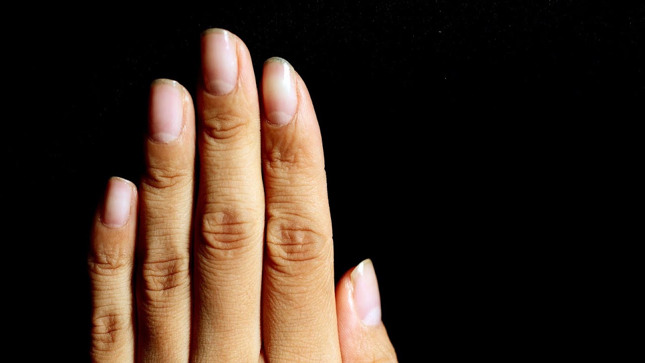 Onychomycosis - Black People Fingernails