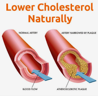 How To Lower Cholesterol Fast
