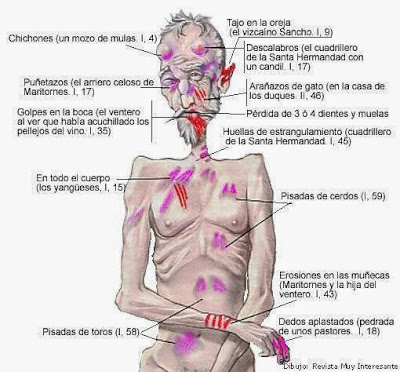 Resultado de imagen de heridas de don quijote