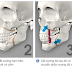  Định nghĩa phẫu thuật hàm hô móm 