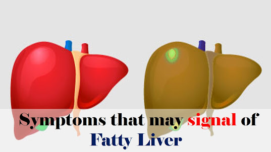 Symptoms that may signal of Fatty liver