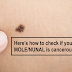 How To Know If Your Moles Are Cancerous or Not: Signs and Symptoms