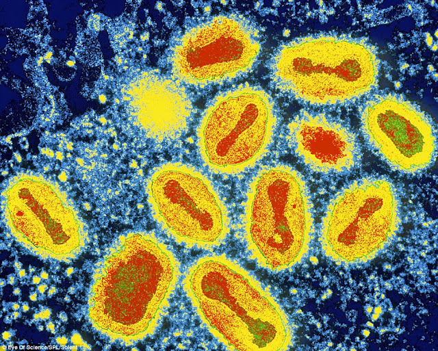 Blognya anak tuban sejati Gambar Bakteri Dan Virus 