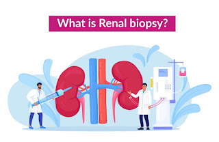 renal-biopsy