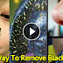 Want To Get Rid Of Your Blackheads Overnight? You Surely Need To Try These Remedies!